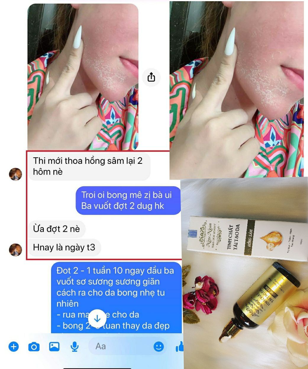 HỒNG SÂM TÁI TẠO DA