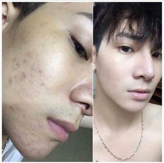 KEM SÂM GUOYAO NHẬT BẢN CHÍNH HÃNG