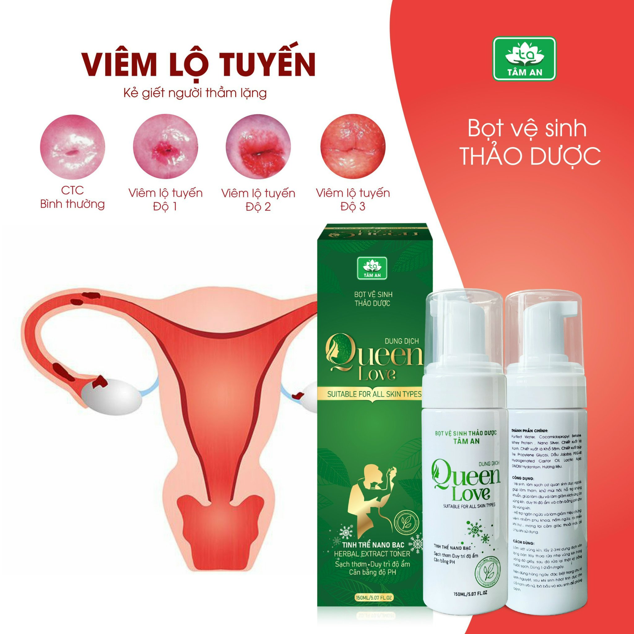 FREESHIP MAX - Bọt vệ sinh Queen Love