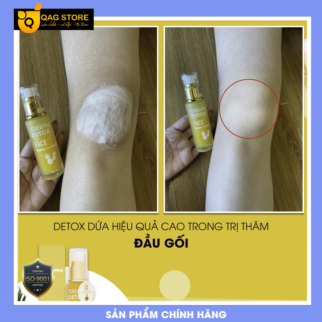 [HCM]THẢI ĐỘC DA DETOX DỨA