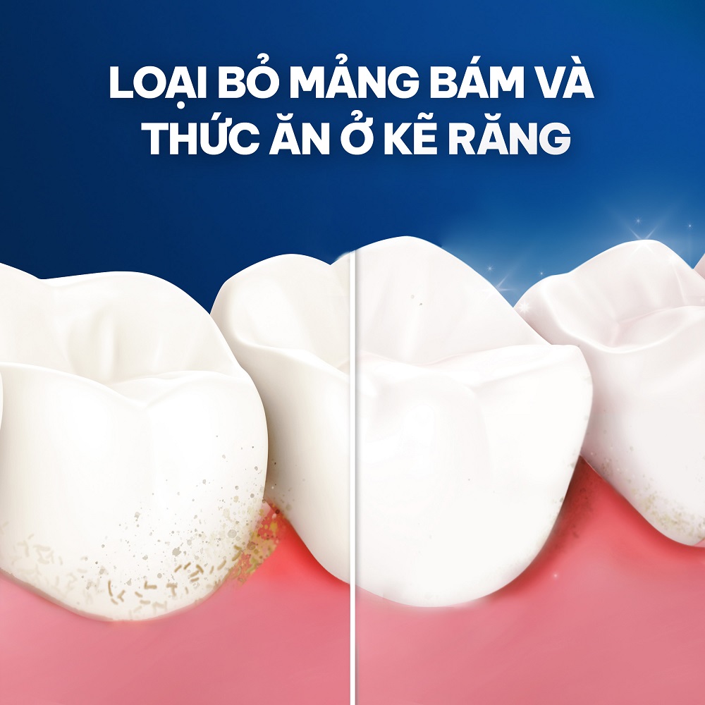 Chỉ Nha Khoa Oral-B 50m