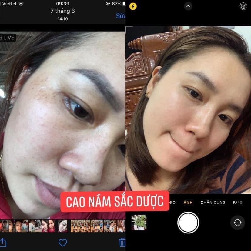Kem Sắc Dược Ngừa Nám Sạm