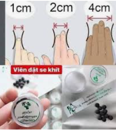 Viên sẽ khít dong y Thái Lan