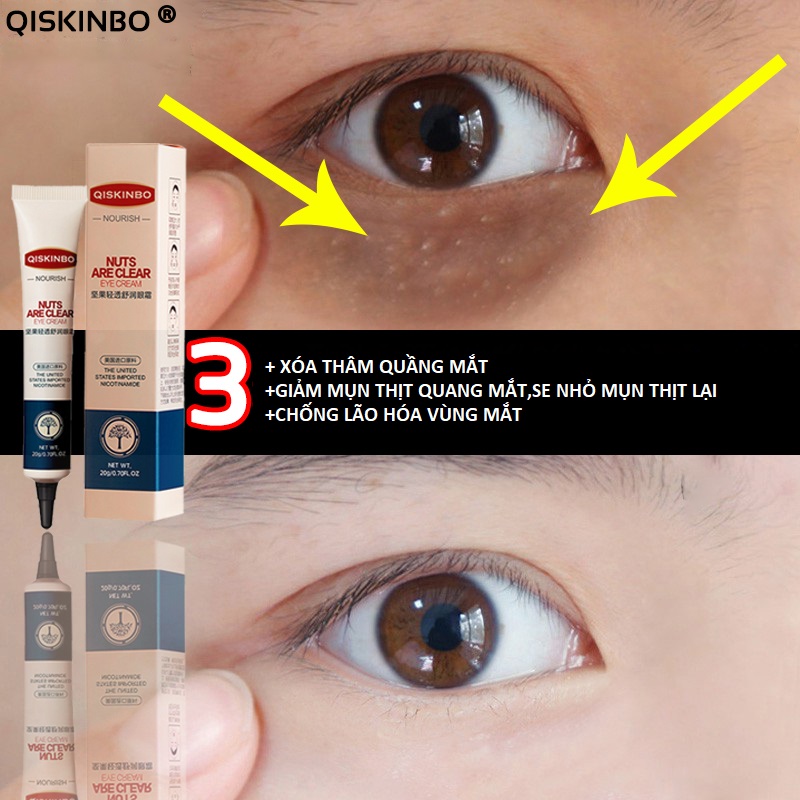 Kem xóa mụn thịt ,loại bỏ túi dưới mắt và các hạt mỡ hiệu quả,Giảm quầng thâm và làm mờ nếp nhăn SKINBO