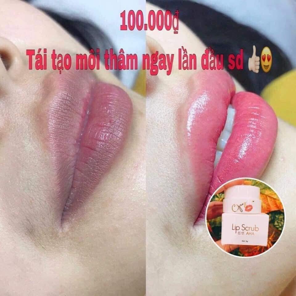 Ủ hồng môi Gong Ju