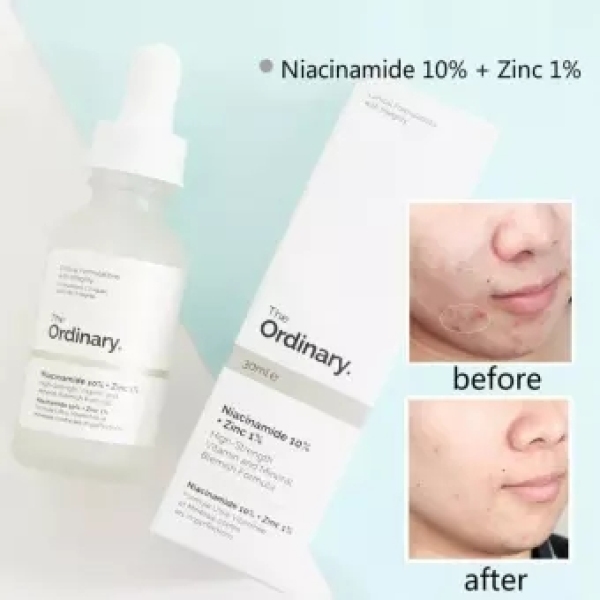 The Ordinary Niacinamide 10% + Zinc 1% 30ML Face Serum Oil Balance Reduce Skin Blemishes Whitening cao cấp