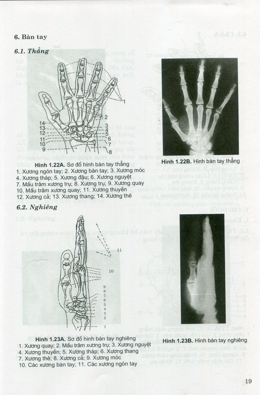Sách - Giải phẫu X - Quang