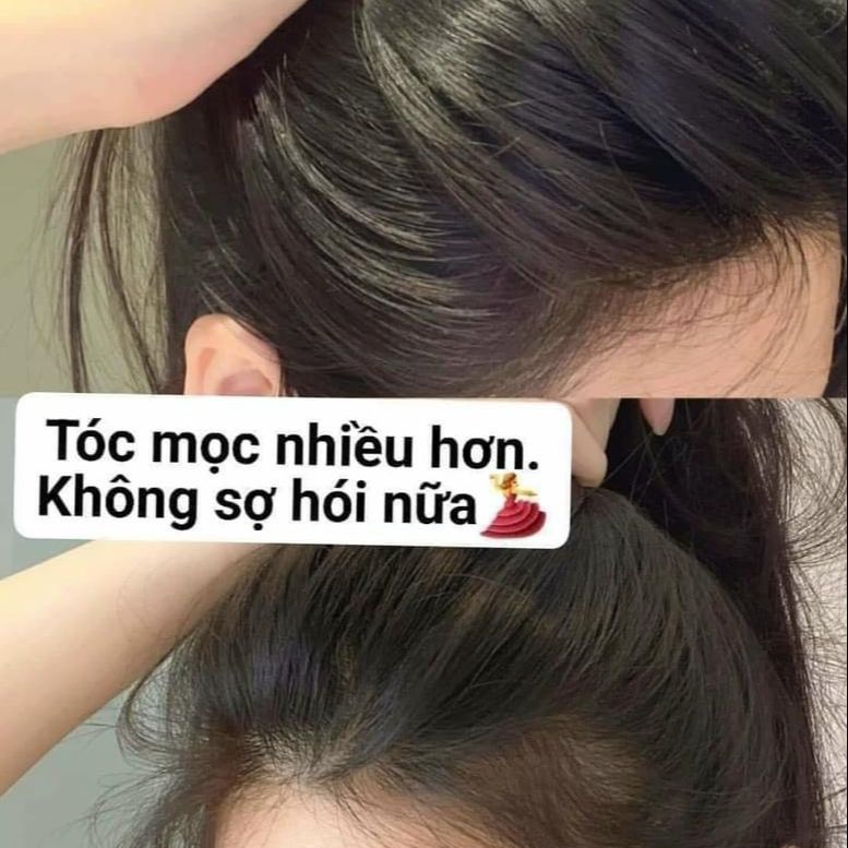 Xịt Mọc Tóc Tinh Dầu Bưởi Sun On Thái Lan 100mL