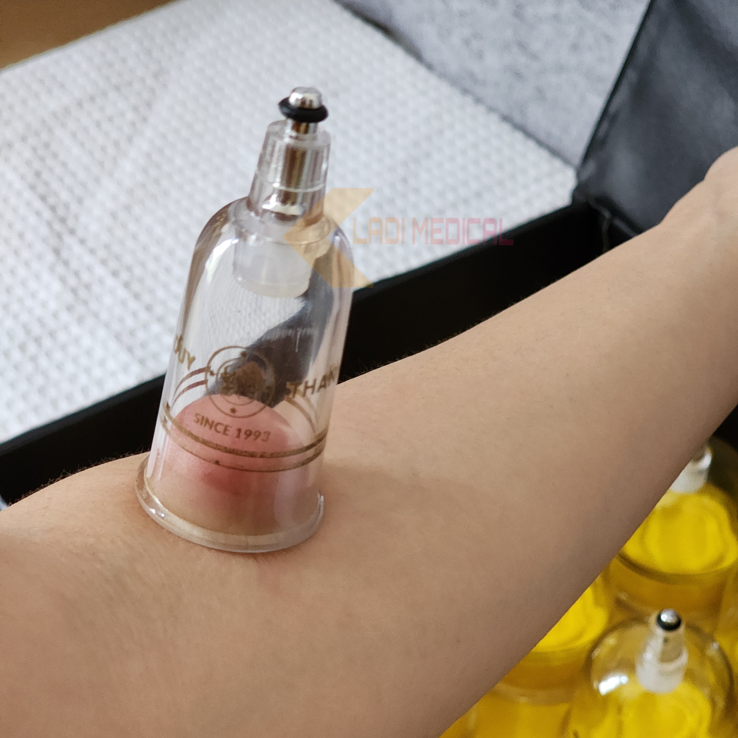 Bộ Giác hơi không dùng lửa Duy Thành Đen YGH02 ( 15 ly )