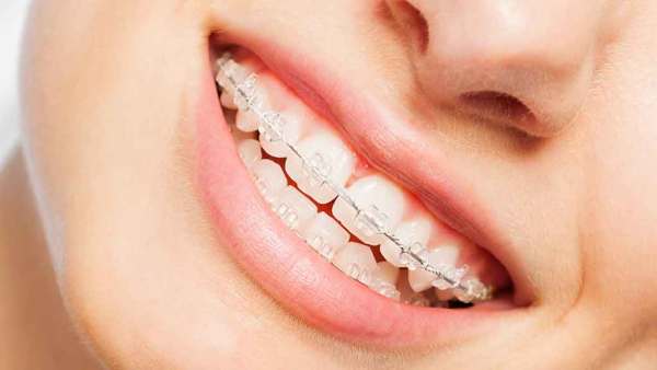 [HCM]SÁP NHA KHOA - GIẢM ĐAU TRONG NIỀNG RĂNG giá rẻ