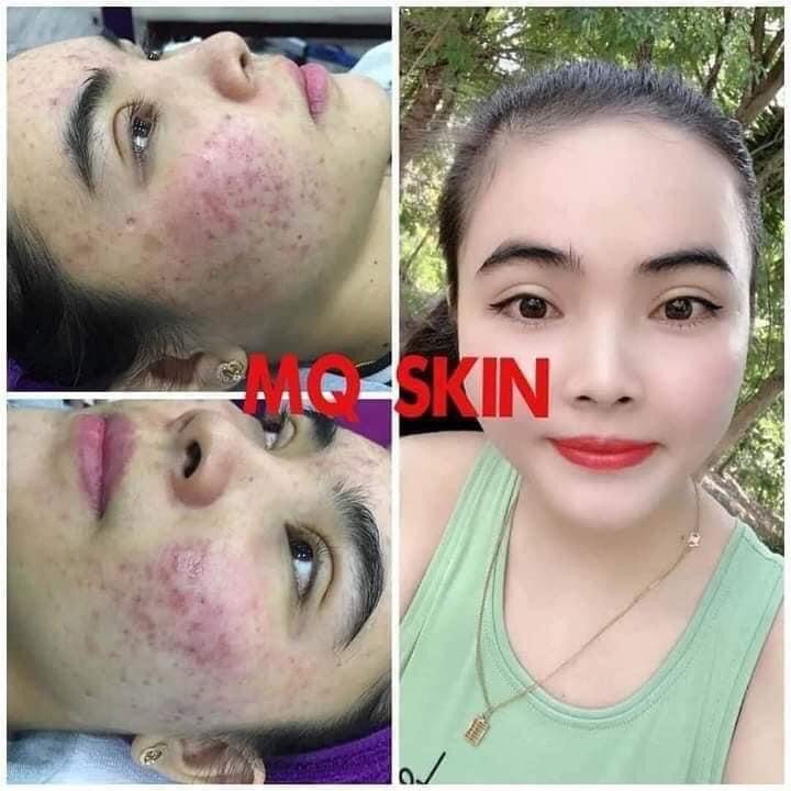 Thay Da Nhân Sâm Mq Skin[Chính Hãng]