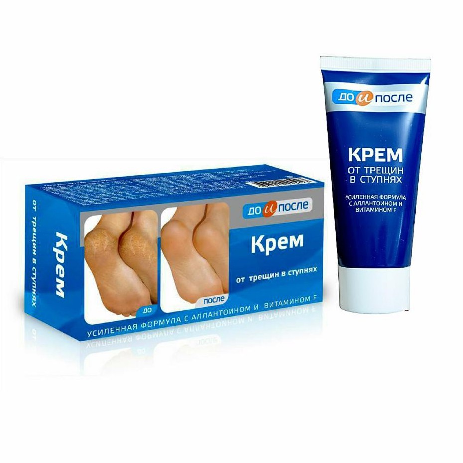 Kem nứt gót chân kpem apteka nga - 50ml