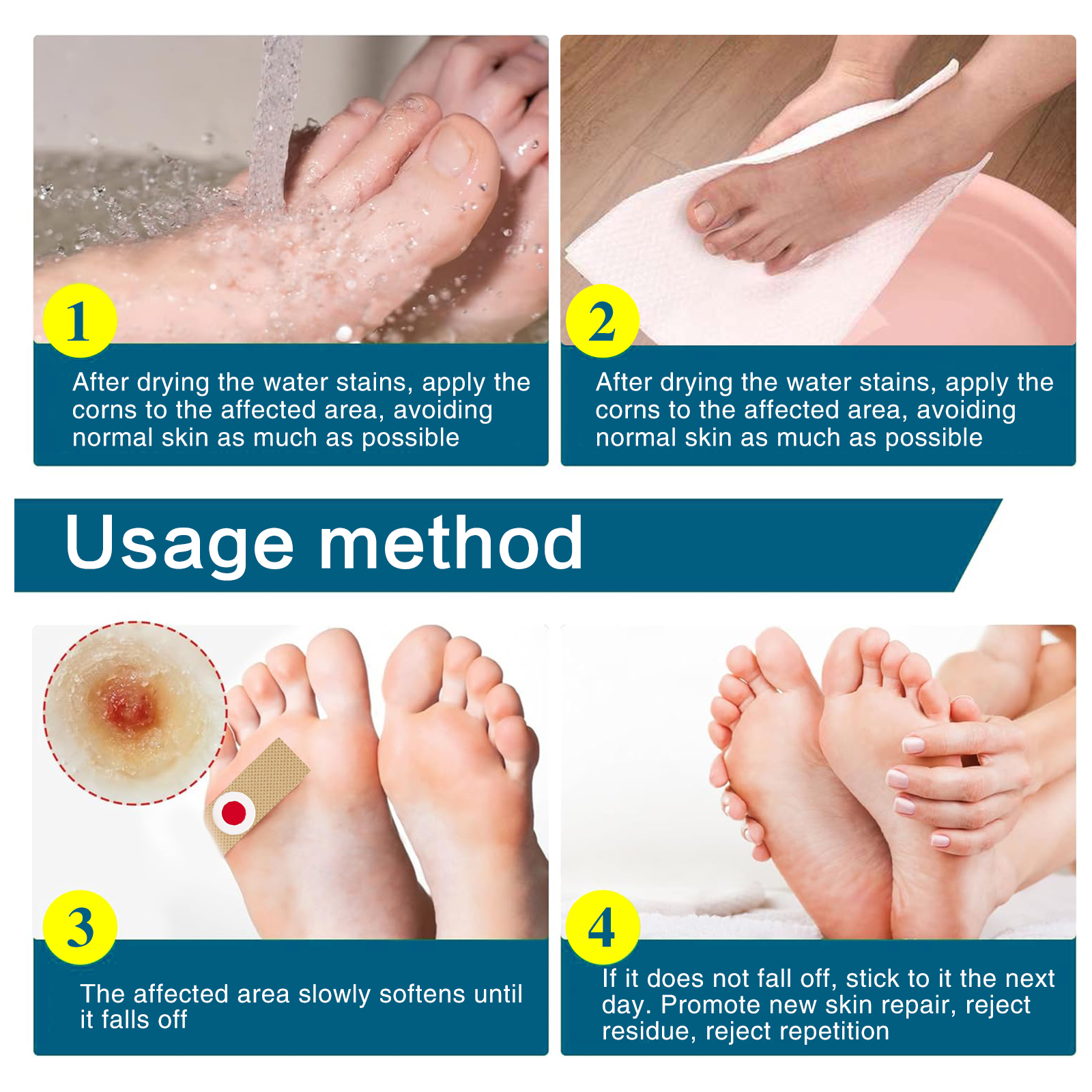 STAETAS 24 miếng miếng dán tẩy da chết Hydrocolloid