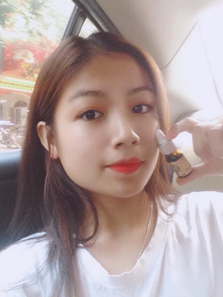 [HCM]Trị mụn Jang Hy