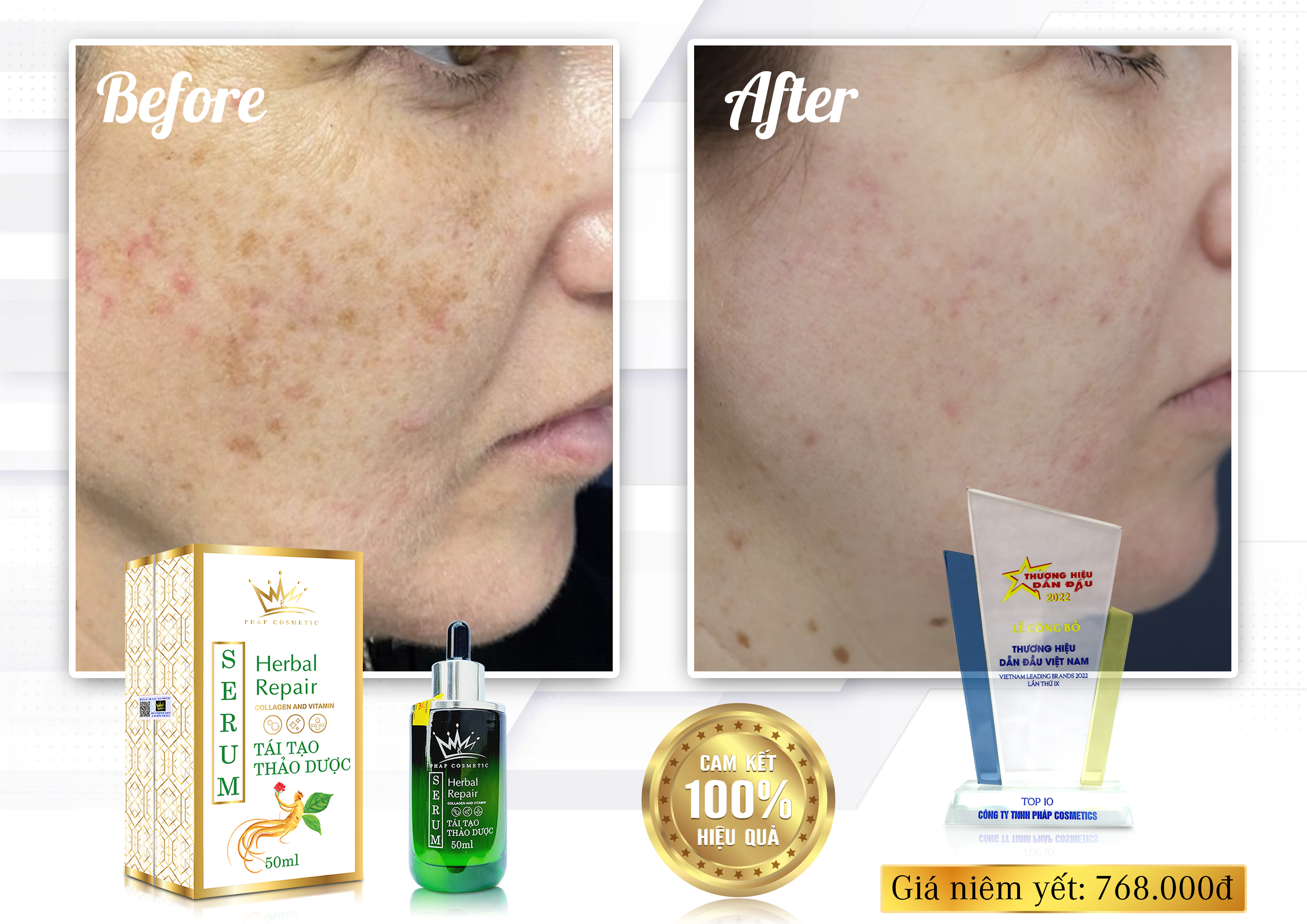SERUM PHÁP TÁI TẠO THẢO DƯỢC