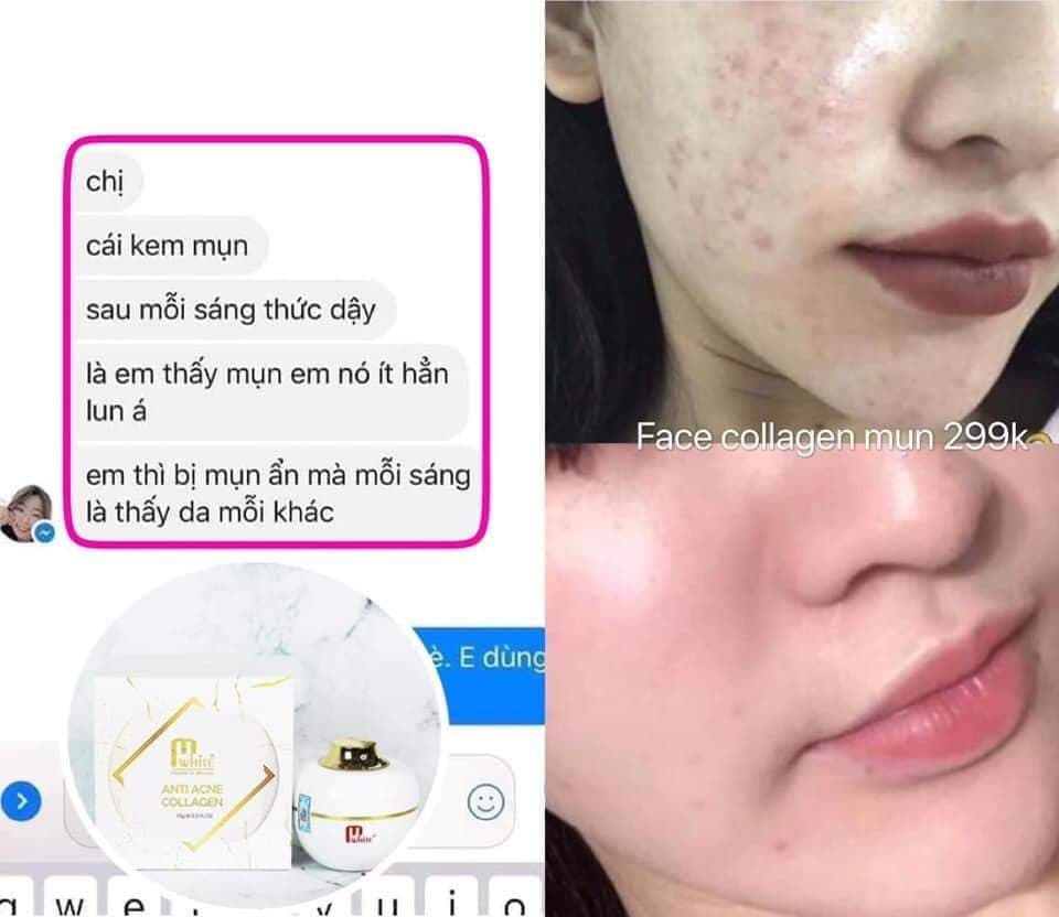 [HCM]Kem face collagen Mwhite D.O.PRO dành cho da mụn