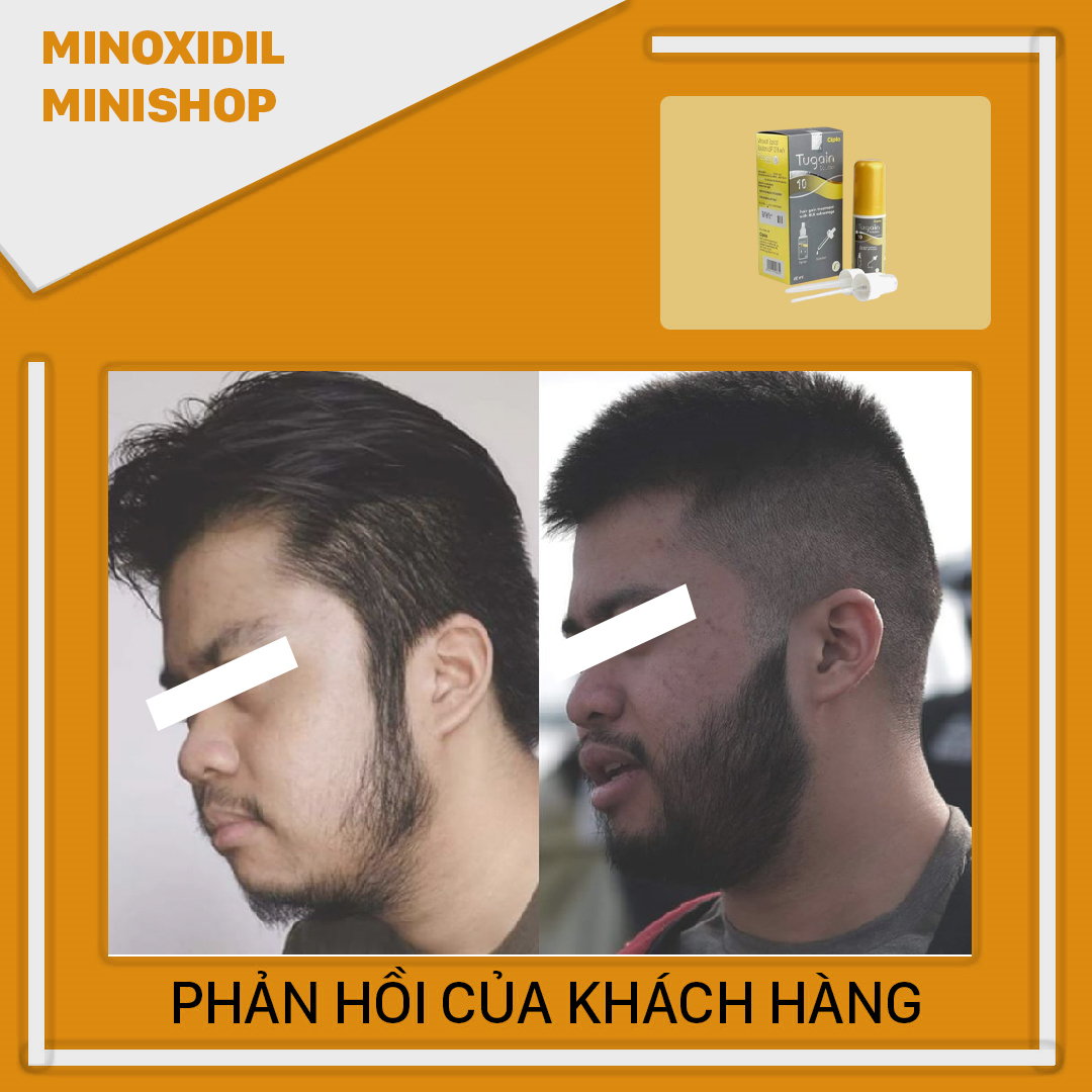 Minoxidil 10% Mọc Râu Tóc Tugain Solulion