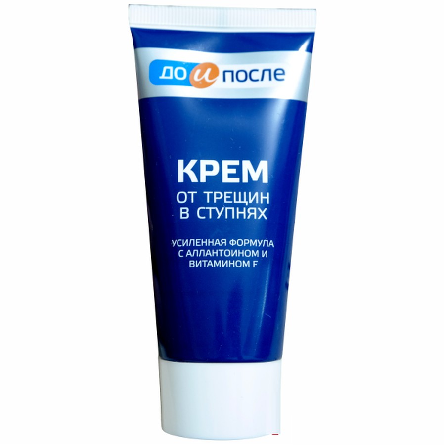 Kem tri nứt gót chân KPEM Nga