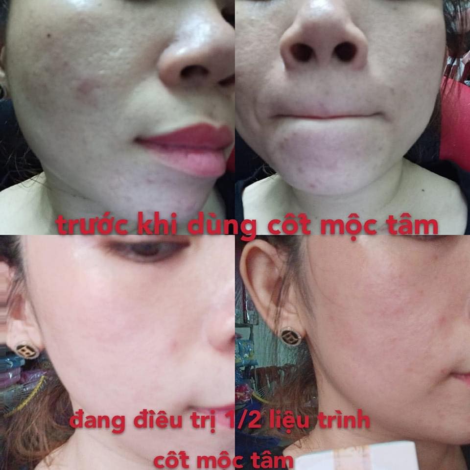Serum Cốt Mộc Tâm Kay Beauty 8ml