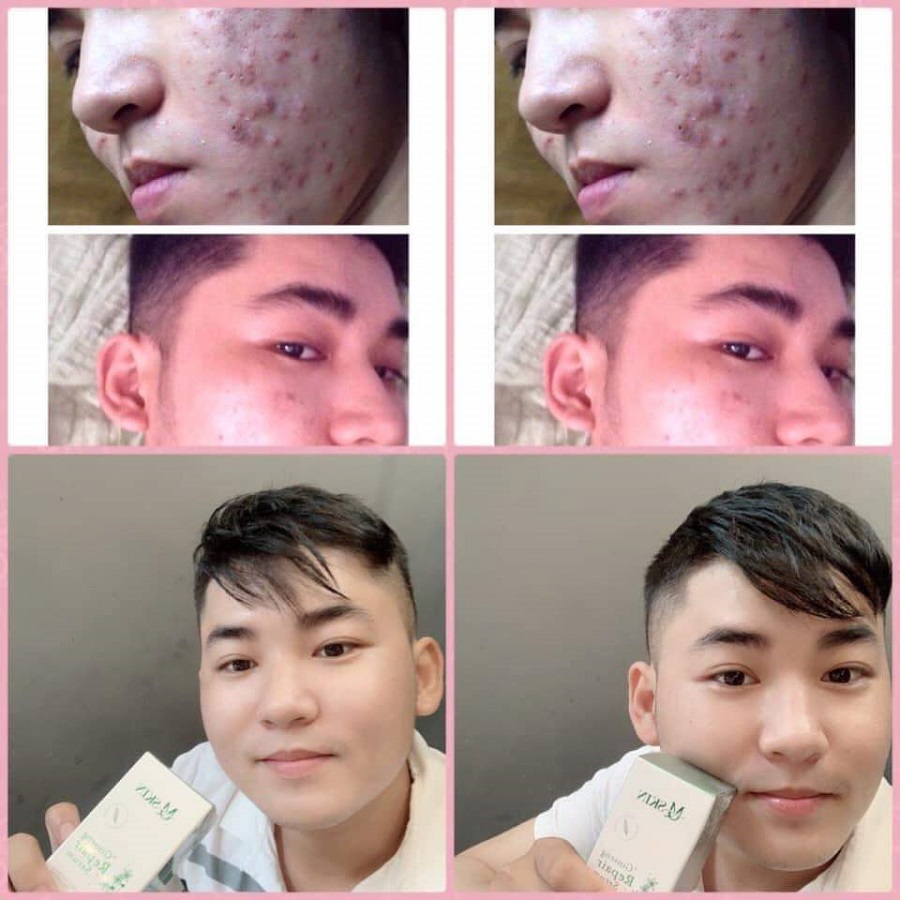 [HCM]SERUM THAY DA NHÂN SÂM MQ SKIN