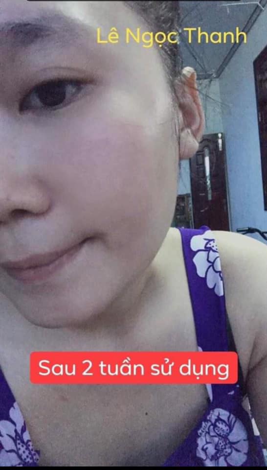 SERUM PHỤC HỒI THÂM NÁM 100% -  PHÚC MINH TÂM