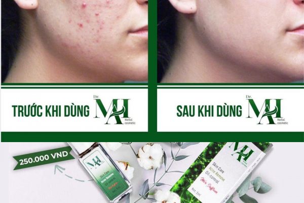 [HCM]DR MAI NGUYEN CHAT 5ML
