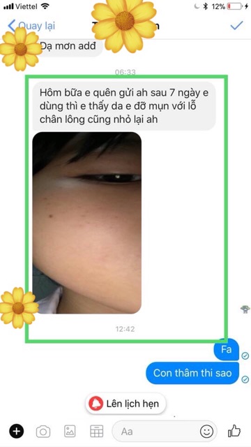 [HCM]Mặt Nạ Dẻo Ngọc Trai Handmade