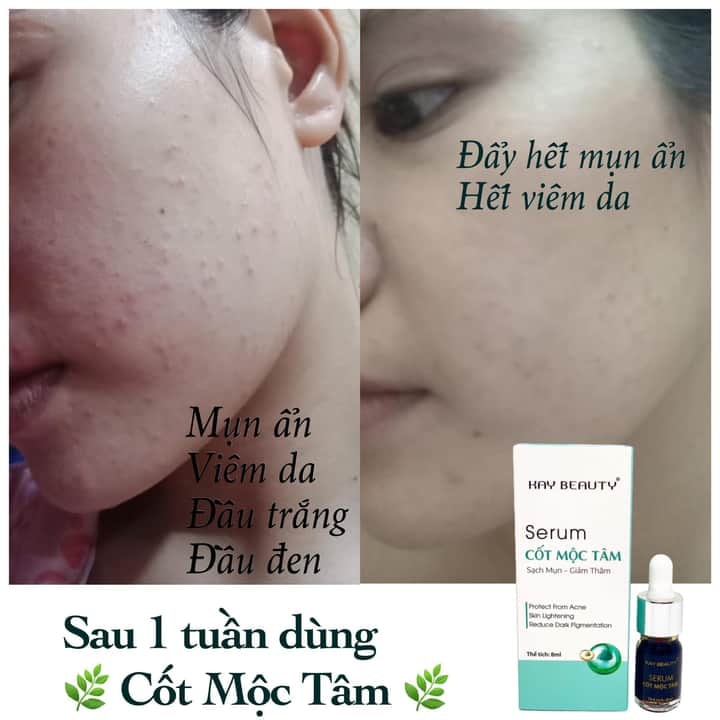 Serum Cốt Mộc Tâm Kay Beauty 8ml