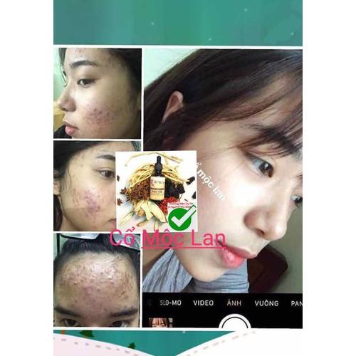 [HCM]Cổ Mộc Lan Siêu Tốc 50ml
