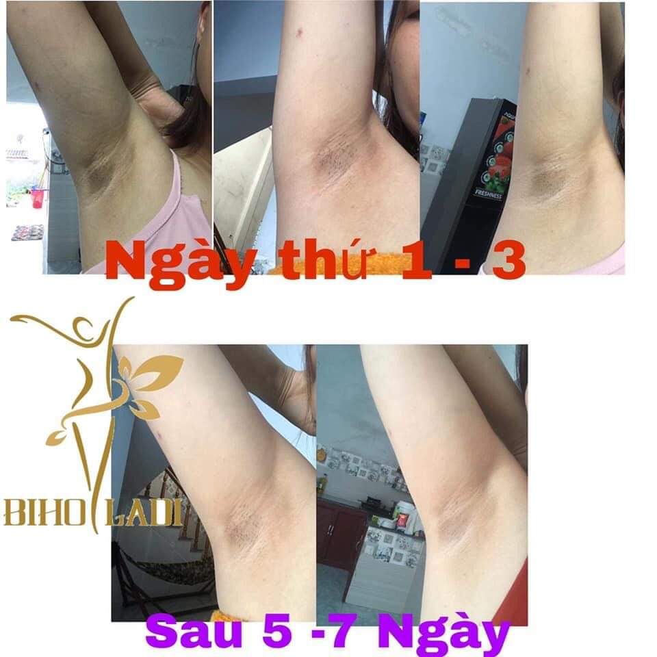 [HCM]Kem siêu dưỡng thâm 5S biho ladi 20g(chuyên khử thâm nách bẹn môngbikini và khử mùi)