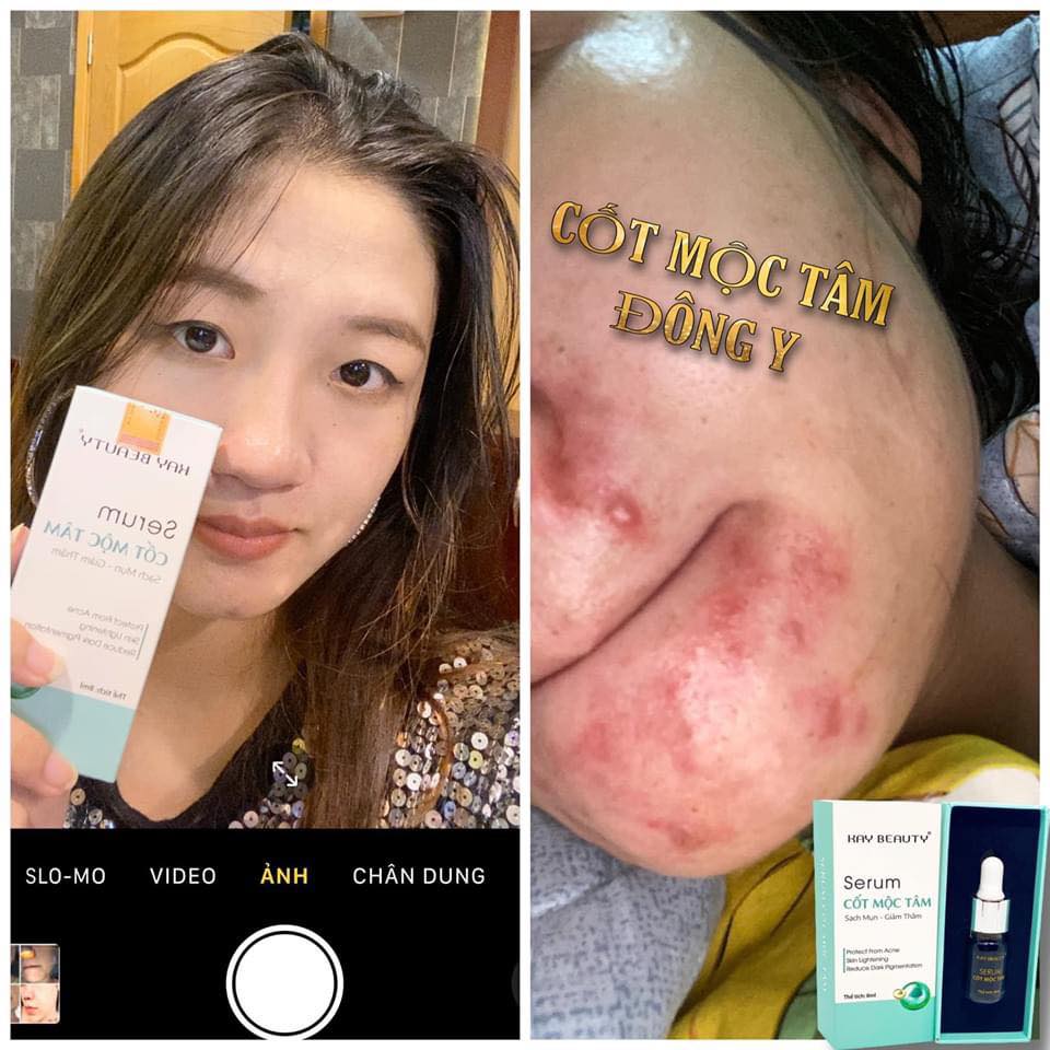 Serum Cốt Mộc Tâm Kay Beauty 8ml