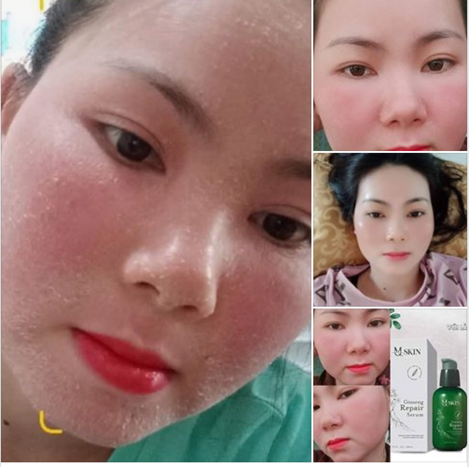 [HCM]COMBO Bột Rửa Mặt MQ + SERUM Thay Da Nhân Sâm