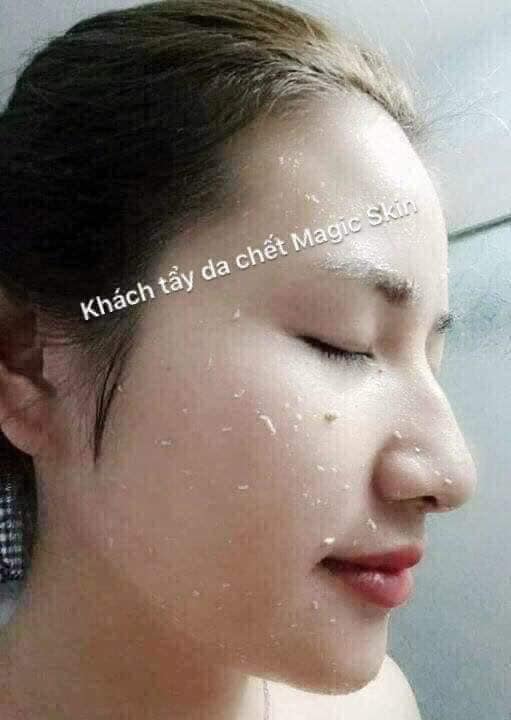 Gel tẩy tế bào chết Magic Skin