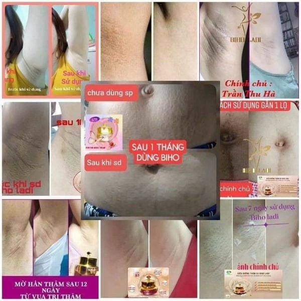 Kem Biho Ladi 5s (Hàng Chính Hãng )