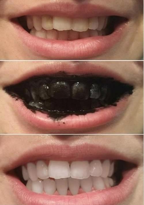 [HCM]Bột Than Tre Hoạt Tính 100 gram - Trị mụn Trắng Răng