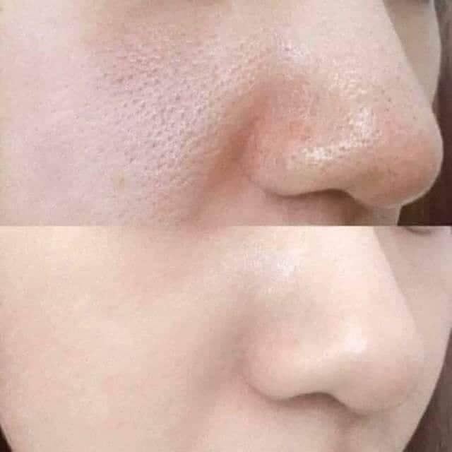 Tế bào gốc se khít lỗ chân lông POCIA, lọ 10ml