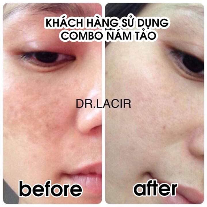 [HCM]Combo Nám Tảo Lamer Care - Dr. Lacir