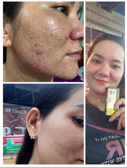 [HCM]DR. MAI NGUYÊN CHÂT