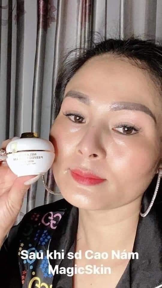 Kem nám Magic skin - Cao nám hoàng cung