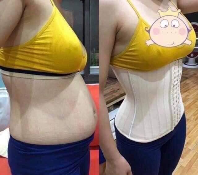 (Sản Phẩm cao cấp) Đai Nịt bụng định hình giảm mỡ eo thon Latex