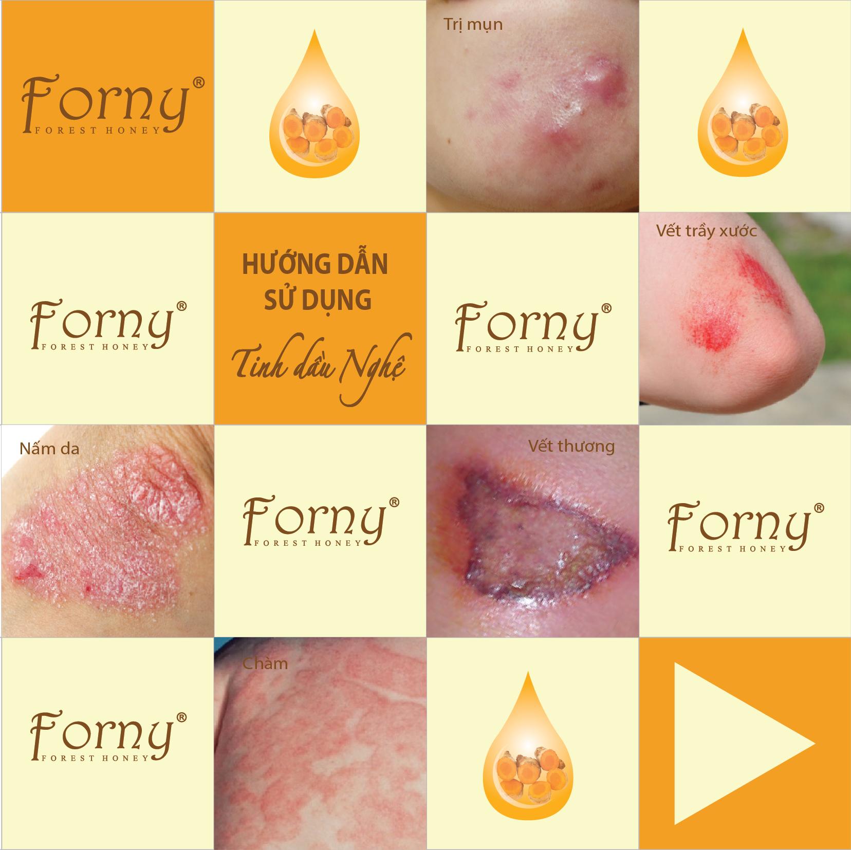 Tinh dầu nghệ Forny 10ml