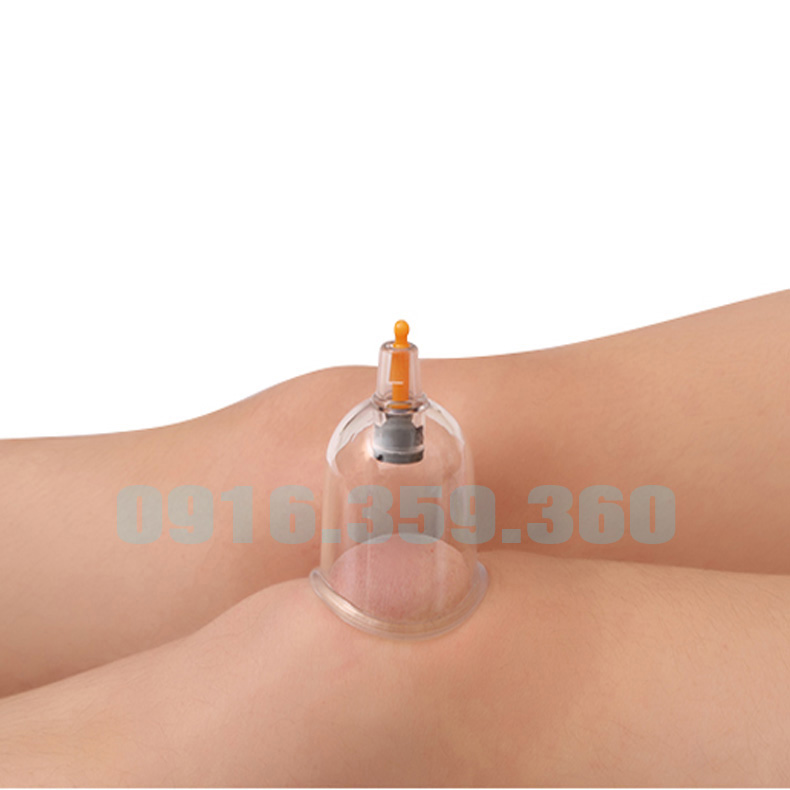 Bộ giác hơi 24 cốc không dùng lửa BY2418