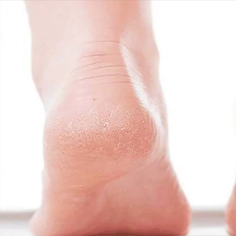 Manuka Doctor Peppermint Foot & Heel Cream 75ml