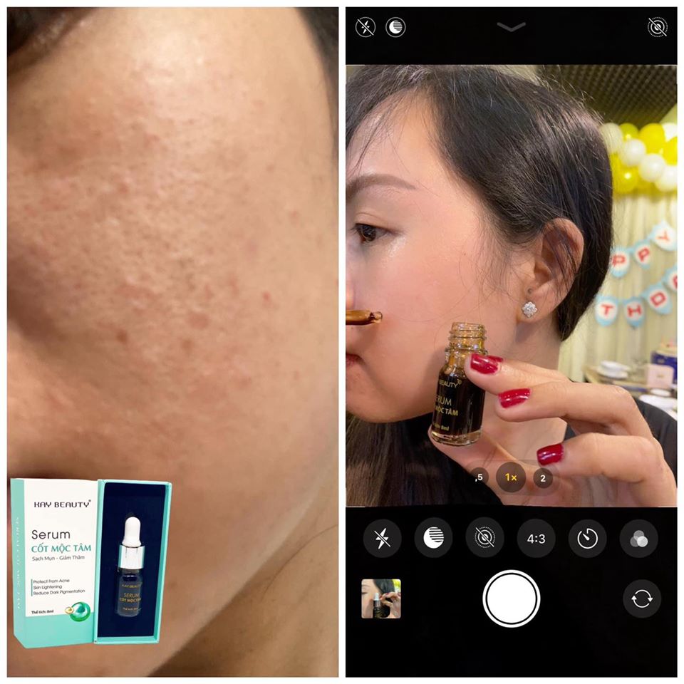 Serum Cốt Mộc Tâm Kay Beauty 8ml