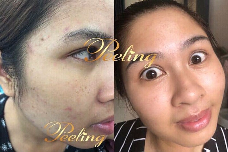 [HCM]Kem Peeling Tái Tạo Da Mặt
