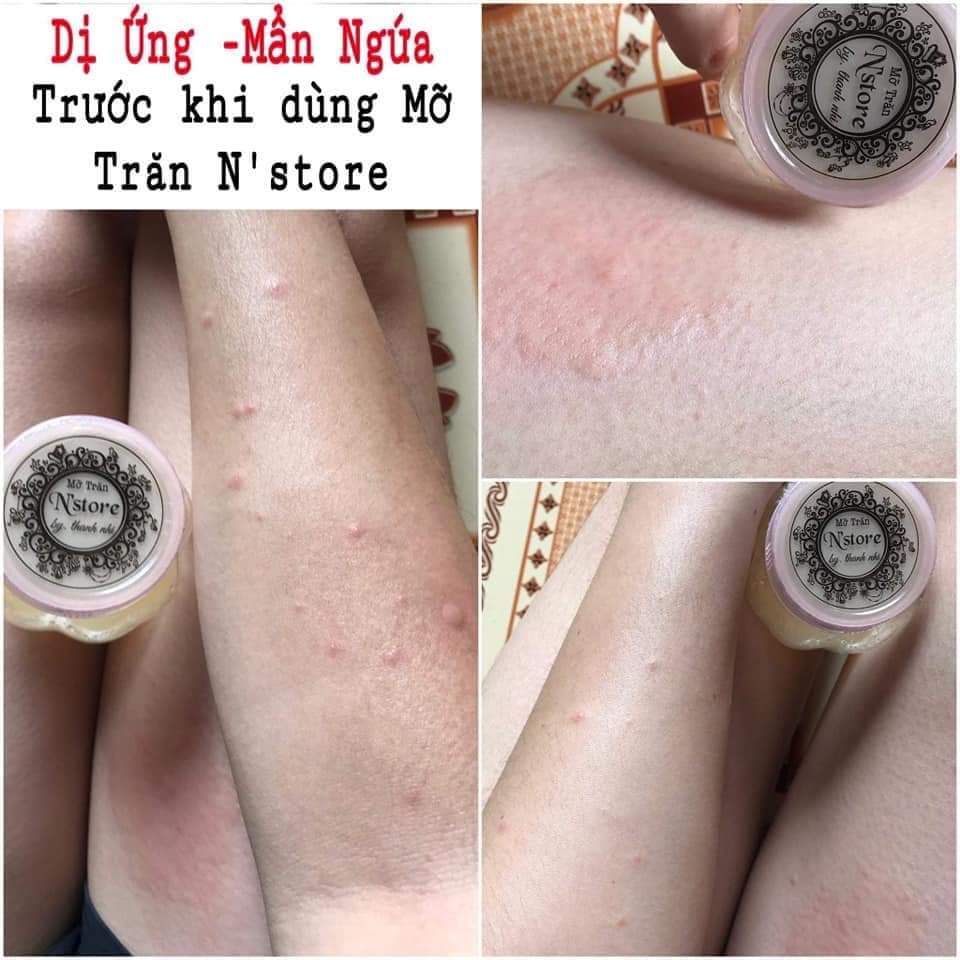 Mỡ Trăn N'STORE