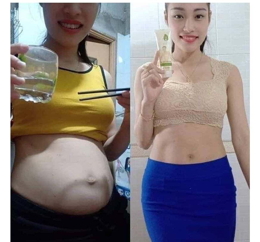 Kem giảm mỡ bụng hiệu quả - gel tan mỡ olic