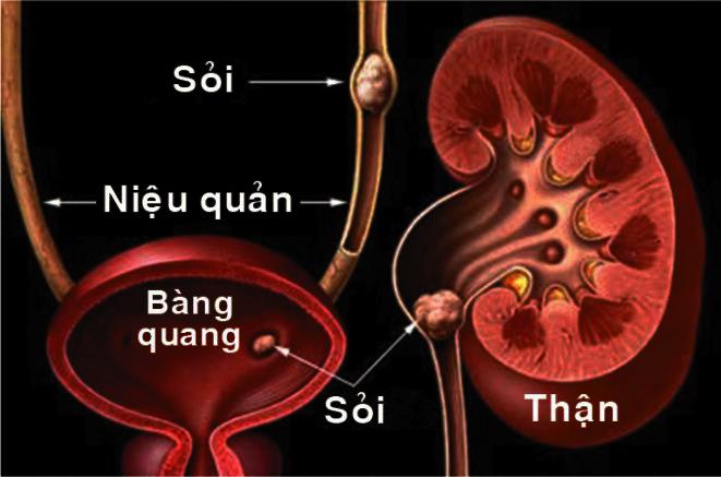 Hạt chuối rừng | Combo | Đơn 2kg