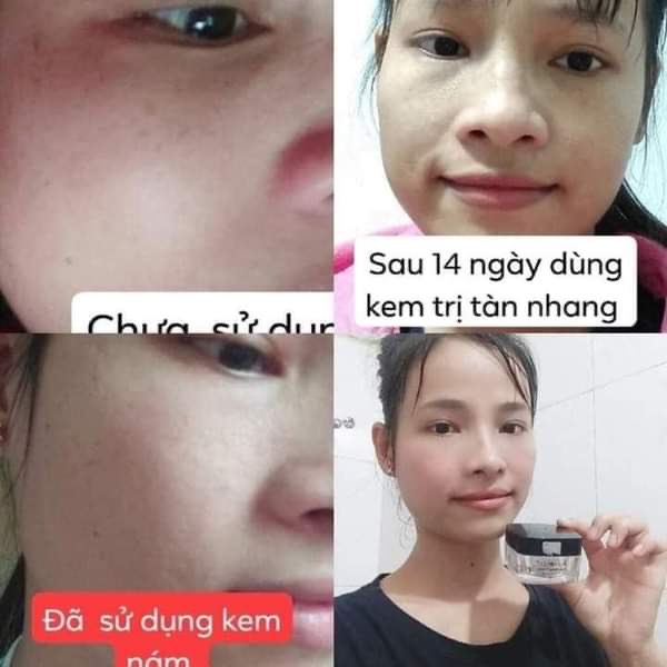 Cao đông y tr.ị nám
