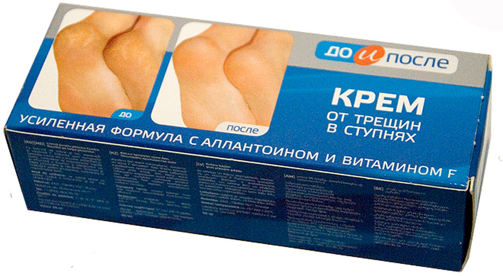 Kem tri nứt gót chân KPEM Nga